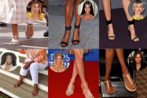 Celebrities with Bunions: Embracing Imperfections