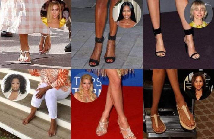 Celebrities with Bunions: Embracing Imperfections